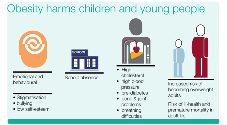 Obesity in childrens