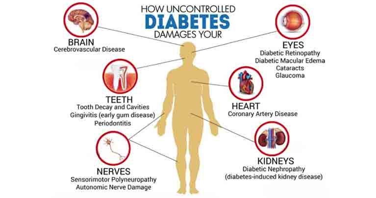 symptoms and signs