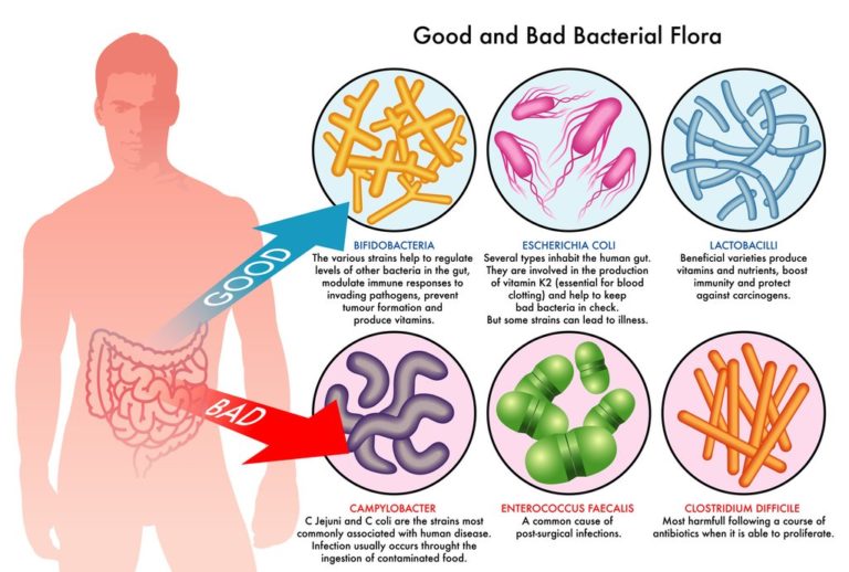 probiotic for IBS