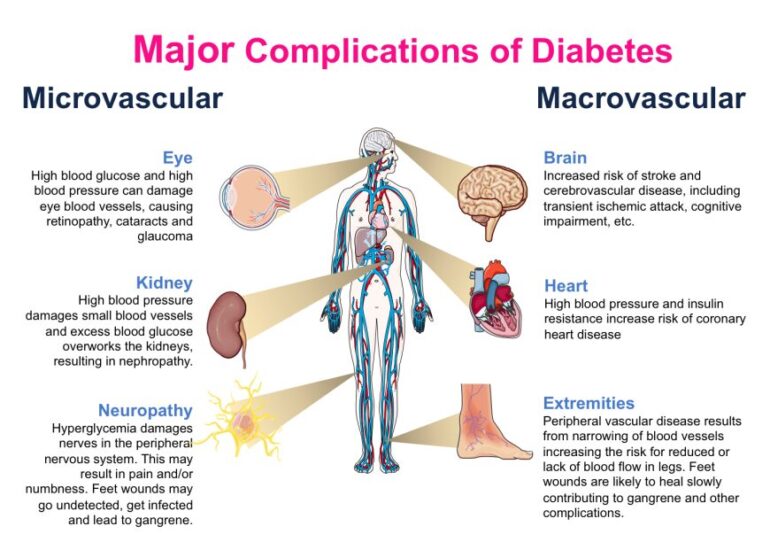 causes and treatment