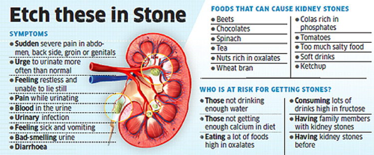 what causes kidney stones
