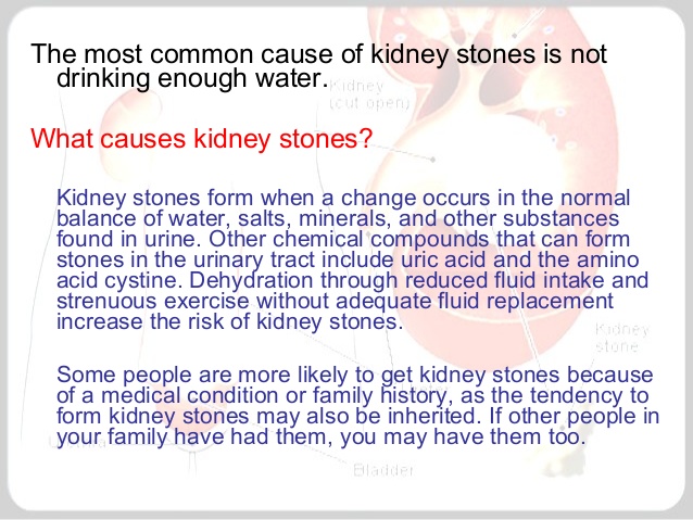 kidney stones