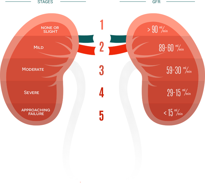 Stages Of Kidney Failure