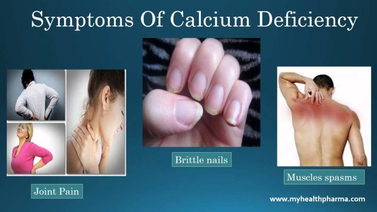 Calcium Deficiency