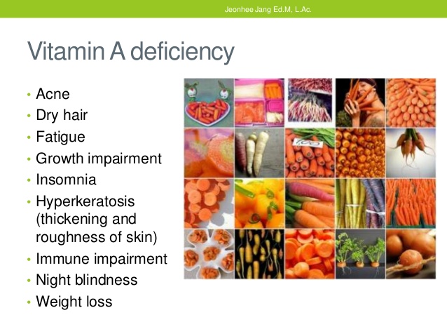 Vitamin A Deficiency