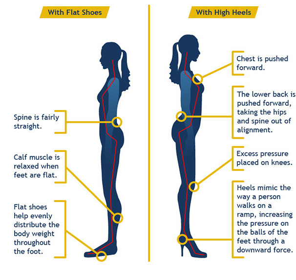 High Heels Effects On Spine, Body, Hips and Knees