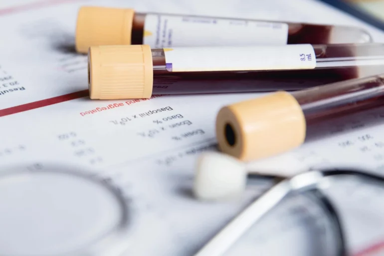 Test Your DHEA Levels at Home